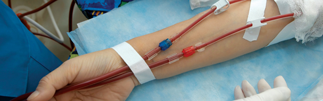 dialysis-access-and-maintenance-lakeland-vascular-institute
