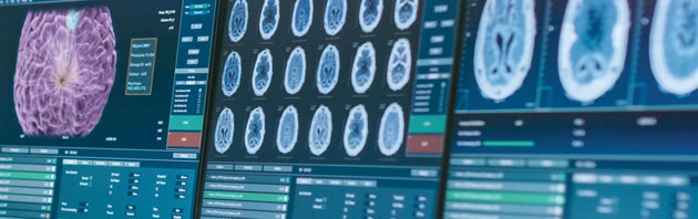 Computer Screens Showing Brain Scans
